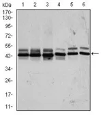 Anti-CSNK2A2 antibody [1E1] used in Western Blot (WB). GTX60636