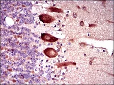 Anti-KEAP1 antibody [7G4B10] used in IHC (Paraffin sections) (IHC-P). GTX60664