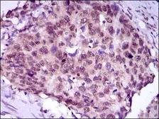 Anti-MEF2C antibody [6H2G2] used in IHC (Paraffin sections) (IHC-P). GTX60668