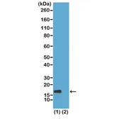 Anti-Histone H3K56ac (Acetyl Lys56) antibody [RM179] used in Western Blot (WB). GTX60902