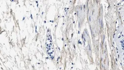 Anti-Collagen III antibody [1E7-D7/Col3] used in IHC (Paraffin sections) (IHC-P). GTX60940