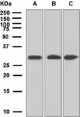Anti-ING4 antibody [EP3804] used in Western Blot (WB). GTX62655