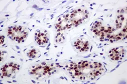 Anti-IKK alpha antibody [EPR464] used in IHC (Paraffin sections) (IHC-P). GTX62710