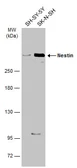 Anti-Nestin antibody [GT935] used in Western Blot (WB). GTX630202