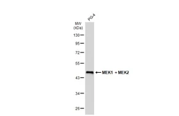 Anti-MEK1 + MEK2 antibody [GT1721] used in Western Blot (WB). GTX630542