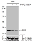 Anti-COPD antibody [GT1318] used in Western Blot (WB). GTX630562