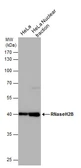 Anti-RNaseH2B antibody [GT673] used in Western Blot (WB). GTX632104