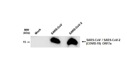 Anti-SARS-CoV / SARS-CoV-2 (COVID-19) ORF7a antibody [3C9] used in Western Blot (WB). GTX632602