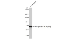 Anti-ZAP70 (phospho Tyr319) / Syk (phospho Tyr352) antibody [GT364] used in Western Blot (WB). GTX634476