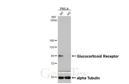 Anti-Glucocorticoid Receptor antibody [GT248] used in Western Blot (WB). GTX634647