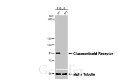 Anti-Glucocorticoid Receptor antibody [GT1073] used in Western Blot (WB). GTX634705