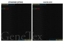 Anti-CA19-9 antibody [GT933] used in Glycan Array (Glycan Array). GTX635389