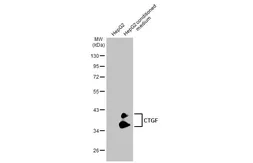 Anti-CTGF antibody [GT1116] used in Western Blot (WB). GTX635971
