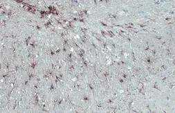 Anti-GFAP antibody [HL1308] used in IHC (Paraffin sections) (IHC-P). GTX636726