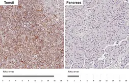Anti-VRL1 antibody [HL1543] used in IHC (Paraffin sections) (IHC-P). GTX637018