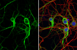 Anti-MAP2 antibody [HL1656] used in Immunocytochemistry/ Immunofluorescence (ICC/IF). GTX637254
