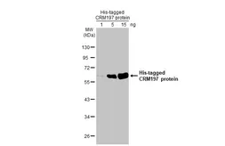 Anti-CRM197 antibody [HL1808] used in Western Blot (WB). GTX637460