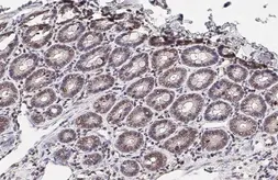 Anti-CD32B antibody [HL1948] used in IHC (Paraffin sections) (IHC-P). GTX637785
