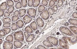 Anti-SIGIRR antibody [HL2008] used in IHC (Paraffin sections) (IHC-P). GTX637909