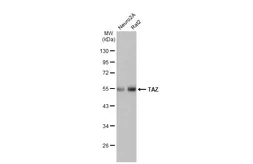 Anti-TAZ antibody [HL2032] used in Western Blot (WB). GTX637933