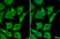 Anti-Bcl-XL antibody [HL2039] used in Immunocytochemistry/ Immunofluorescence (ICC/IF). GTX637940