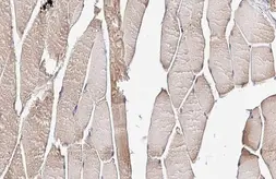Anti-ALP / PDLIM3 antibody [HL2075] used in IHC (Paraffin sections) (IHC-P). GTX637983