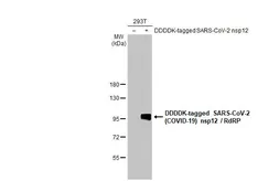 Anti-SARS-CoV-2 (COVID-19) nsp12 / RdRP antibody [HL2221] used in Western Blot (WB). GTX638225