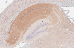 Anti-PKC gamma antibody [HL2226] used in IHC (Paraffin sections) (IHC-P). GTX638271