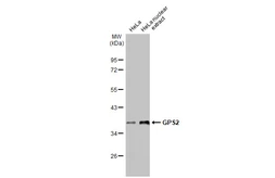 Anti-GPS2 antibody [HL2276] used in Western Blot (WB). GTX638329
