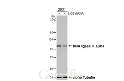 Anti-DNA ligase III antibody [HL2280] used in Western Blot (WB). GTX638333