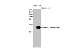 Anti-Mpox virus A29L antibody [HL2527] used in Western Blot (WB). GTX638888