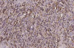 Anti-CTLA4 antibody [HL2732] used in IHC (Paraffin sections) (IHC-P). GTX639560