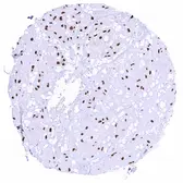 Anti-Brachyury antibody [HMV321] HistoMAX&trade; used in IHC (Paraffin sections) (IHC-P). GTX639945