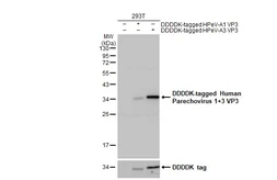 Anti-Human Parechovirus 1+3 VP3 antibody [HL2443] used in Western Blot (WB). GTX640154