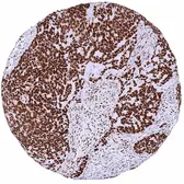 Anti-NFIX antibody [HMV329] HistoMAX&trade; used in IHC (Paraffin sections) (IHC-P). GTX640561