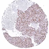 Anti-PARP antibody [HMV334] HistoMAX&trade; used in IHC (Paraffin sections) (IHC-P). GTX640566