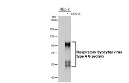 Anti-Respiratory Syncytial virus type A G protein antibody [HL3122] used in Western Blot (WB). GTX640598