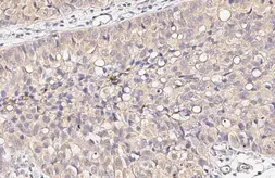 Anti-NDP52 antibody [HL3126] used in IHC (Paraffin sections) (IHC-P). GTX640612