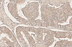 Anti-CXCR6 antibody [HL3144] used in IHC (Paraffin sections) (IHC-P). GTX640636