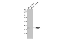 Anti-MC5 Receptor antibody [HL3178] used in Western Blot (WB). GTX640696