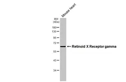 Anti-Retinoid X Receptor gamma antibody [HL3185] used in Western Blot (WB). GTX640824