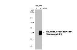 Anti-Influenza A virus H1N1 HA (Hemagglutinin) antibody [HL3261] used in Western Blot (WB). GTX640908