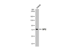 Anti-SP2 antibody [HL3271] used in Western Blot (WB). GTX640925