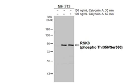 Anti-RSK3 (phospho Thr356/Ser360) antibody [HL3299] used in Western Blot (WB). GTX640988