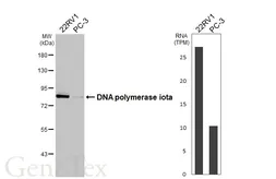 Anti-DNA polymerase iota antibody [HL3310] used in Western Blot (WB). GTX641072