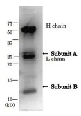 Anti-E. coli LT toxin antibody used in Immunoprecipitation (IP). GTX64109