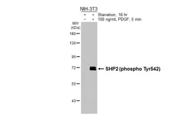 Anti-SHP2 (phospho Tyr542) antibody [HL3334] used in Western Blot (WB). GTX641099