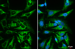 Anti-MFF antibody [GT26] used in Immunocytochemistry/ Immunofluorescence (ICC/IF). GTX641105
