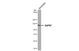 Anti-SAP97 antibody [GT31] used in Western Blot (WB). GTX641123