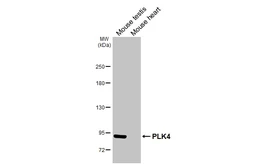 Anti-PLK4 antibody [HL3371] used in Western Blot (WB). GTX641191